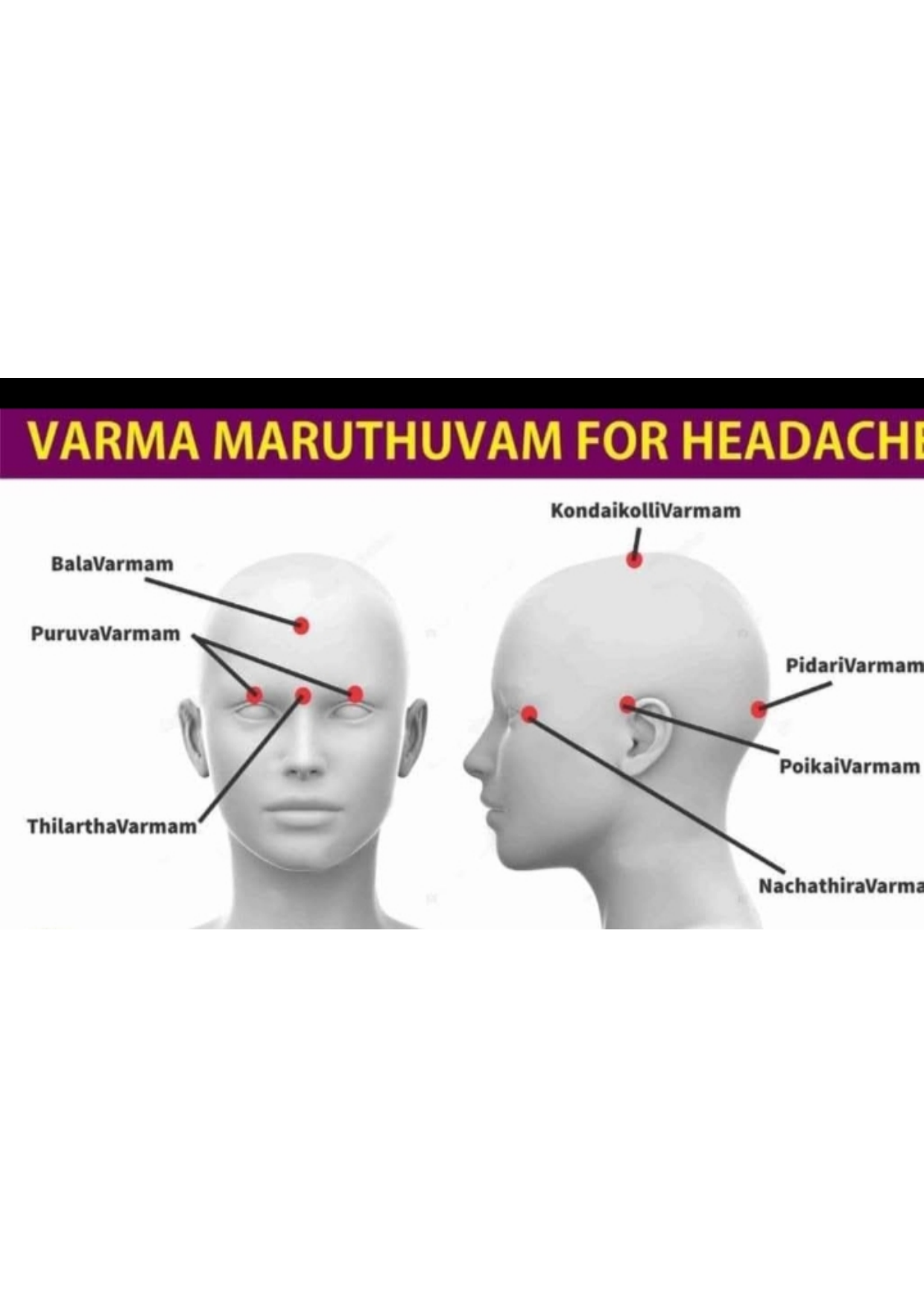 Varma therapy for headache diagram